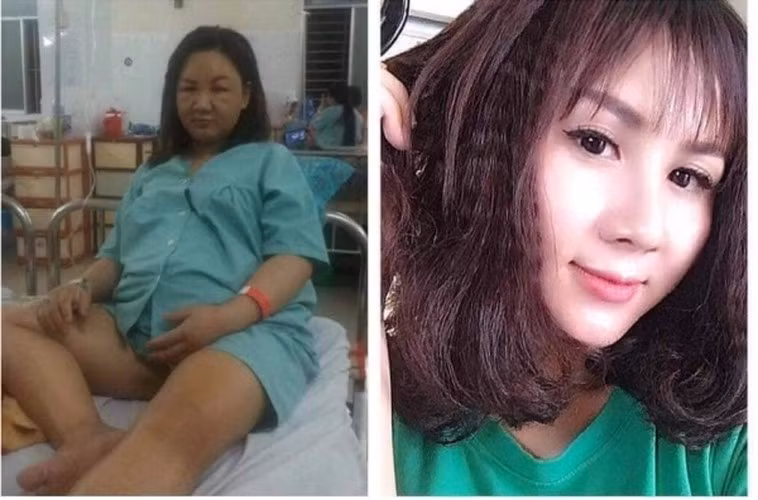 Hot girl khi mang bầu cũng chịu chung "lời nguyền" xấu xí mà thôi.