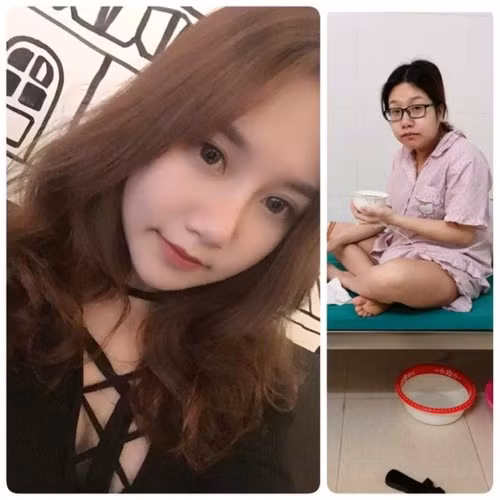 Đó là chưa kể đến, mang bầu có thể gây ra những vết rạn xấu xí trên da khó có thể xóa mờ.