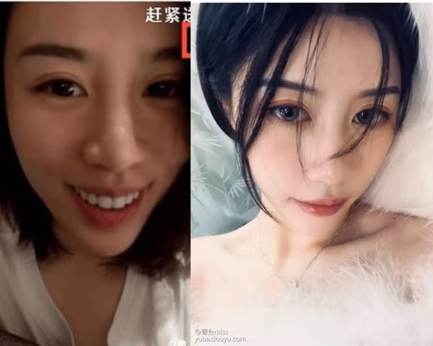Dân mạng không ngừng chỉ ra sự khác biệt giữa hai trạng thái khi lên sóng của nữ streamer, ví dụ như: mũi khá thô, trán cao, đôi môi dày…