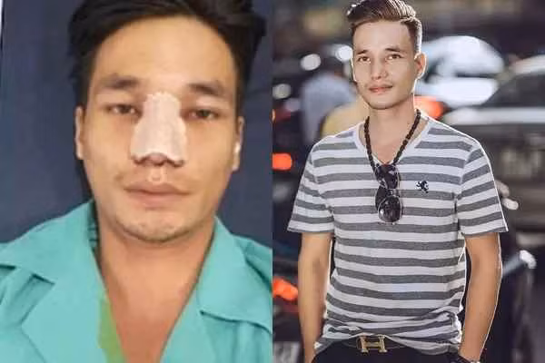 Liên quan đến chuyện quay trở lại showbiz, mới đây Lệ Rơi có chia sẻ gây chú ý. Theo đó, anh tiết lộ những hình ảnh trên được ghi lại khi tham gia bữa tiệc tất niên công ty của một người bạn. Tại đây, anh đóng vai trò MC của sự kiện.