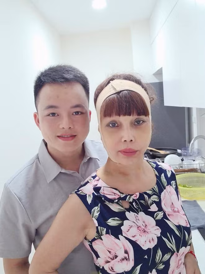 Nói thêm về mong muốn phẫu thuật thẩm mỹ của cô dâu Cao Bằng thì không thể phủ nhận rằng việc lấy một người chồng trẻ như Hoa Cương đã thôi thúc Thu Sao lúc nào cũng phải tìm đến các phương pháp làm đẹp để níu kéo tuổi thanh xuân.