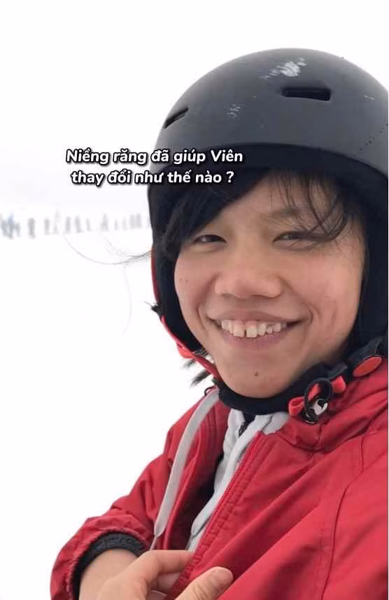 Dù thăng hạng nhan sắc hơn hẳn, Ánh Viên chưa bao giờ chối bỏ quá khứ chưa xinh của mình. Cô thường chia sẻ lại hình ảnh trong quá khứ như 1 cách để thể hiện sự biết ơn nỗ lực của chính mình trong hành trình "lột xác" để toả sáng hơn.