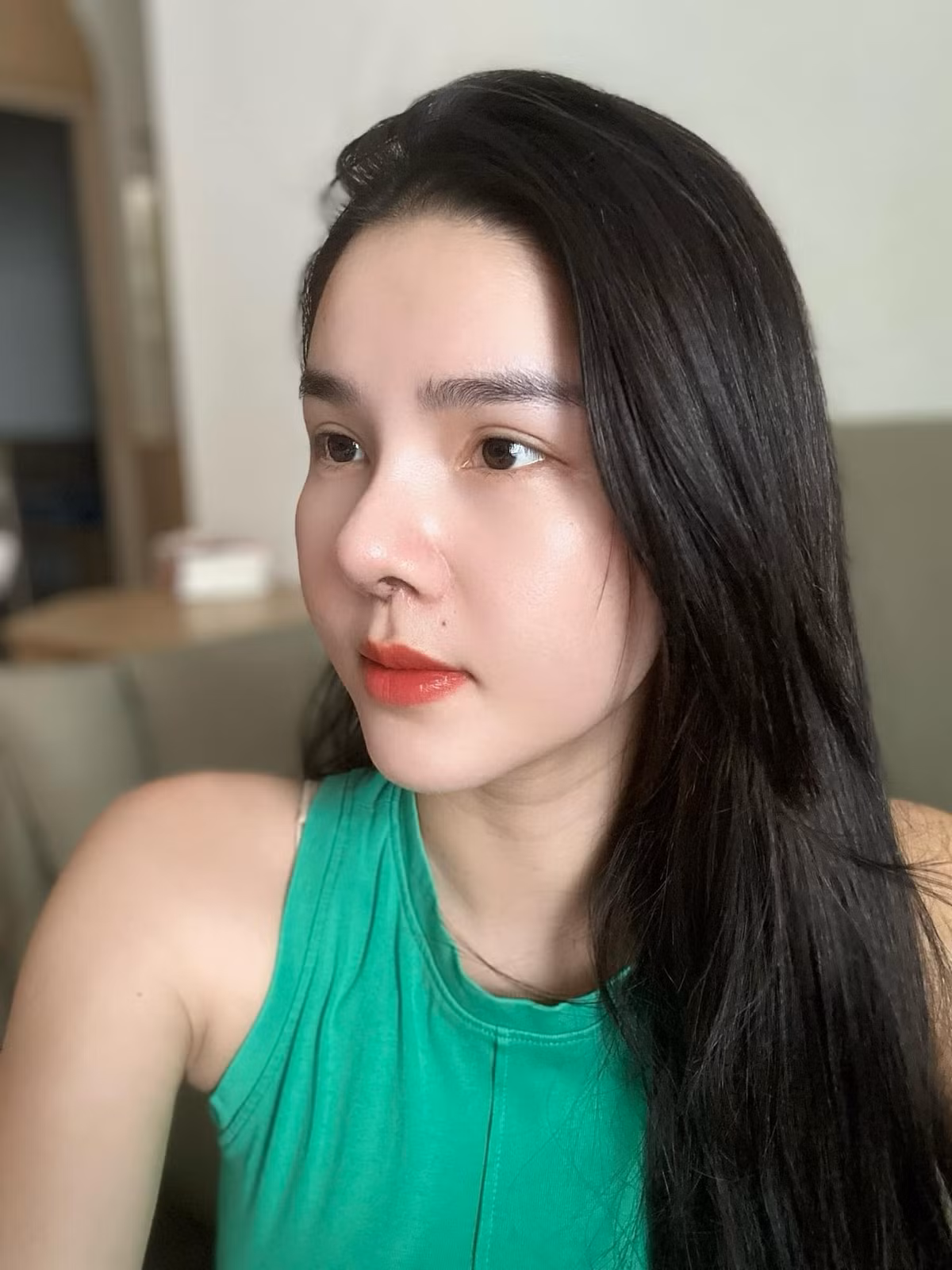 Mới đây, trên trang Facebook cá nhân, vợ của Mạc Hồng Quân là Kỳ Hân gây chú ý khi đăng tải hình ảnh mũi sau phẫu thuật thẩm mỹ 10 ngày.