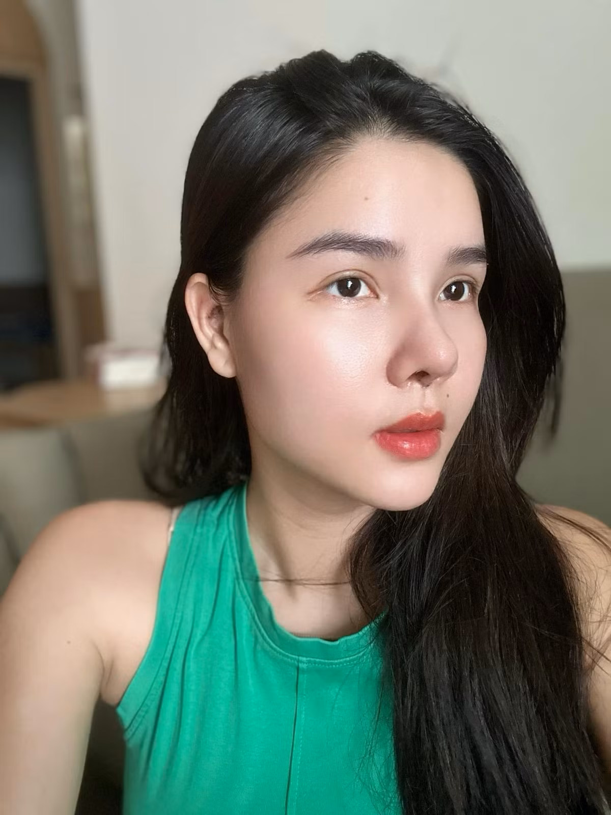 Siêu mẫu Kỳ Hân chia sẻ: "Trộm vía không bị bầm tím hay bầm vàng gì luôn. Phần là bác sĩ mát tay. Phần là do cơ địa mình cũng lành. Mình chưa đến ngày cắt chỉ, và mũi cũng còn sưng".