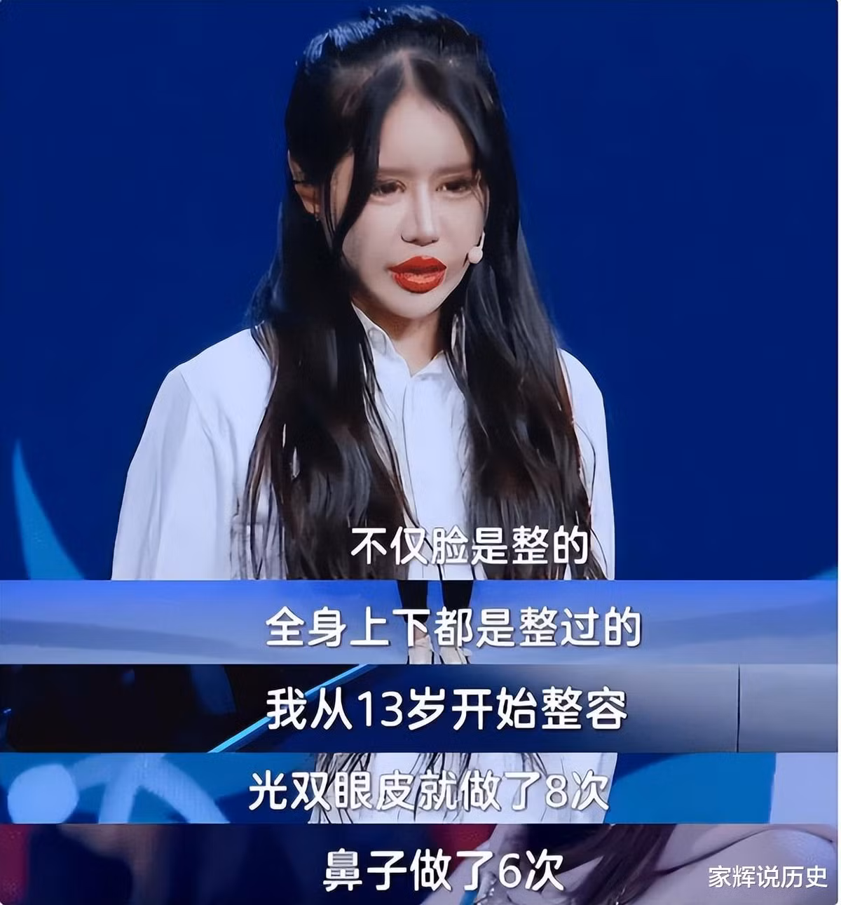 Có lần thời gian hồi phục phẫu thuật thẩm mỹ đặc biệt dài, Chu Sở Na chọn cách ở nhà, lướt mạng xã hội, vào diễn đàn cộng đồng phẫu thuật thẩm mỹ tham khảo.