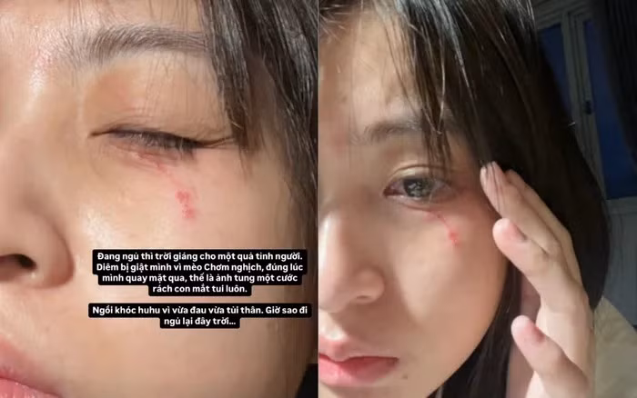 Nguyen Lam Thao Tam bi thu cung 