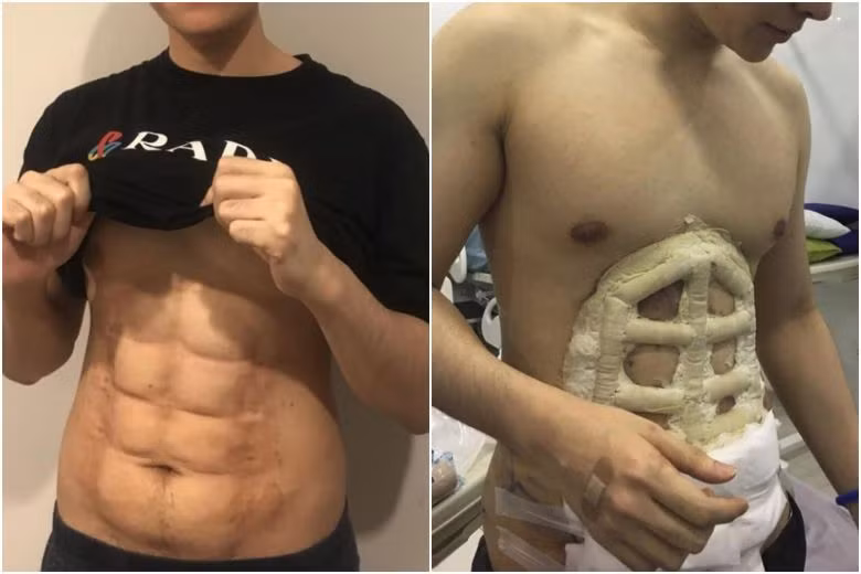 Tuy vậy, xăm cơ bụng 6 múi chỉ là giải pháp tạm thời cho phần nhìn. Việc quan trọng hơn cả đó chính là sức khỏe của mỗi người, do đó, tập thể dục, thể thao vẫn nên được ưu tiên hơn.