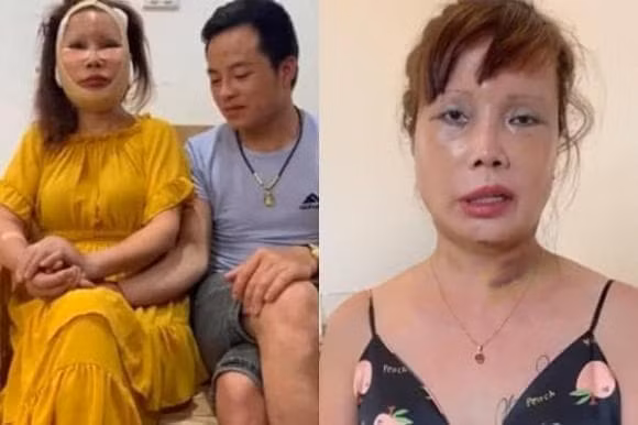 Hiện tại, cô Thu Sao ở tuổi 68 vẫn có làn da trắng sáng, ít nếp nhăn, mũi cao thẳng tắp