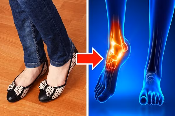 Sai lầm khi chọn giày dép mùa hè có thể ảnh hưởng sức khỏe Sai lam khi chon giay dep mua he co the anh huong suc khoe