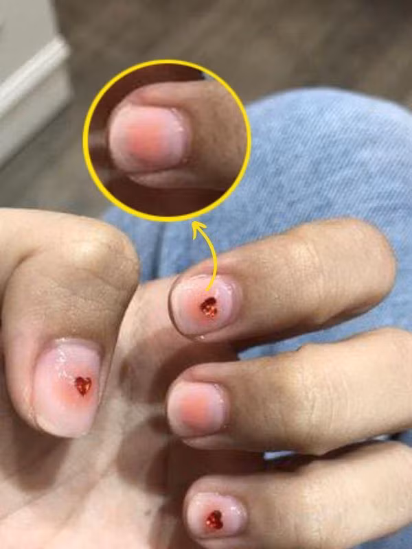 Nhìn vào hình ảnh cô nàng đăng tải có thể thấy, bộ nail trên được làm khá sơ sài. Nhìn vào tay có thể thấy, cô nàng chưa được nhặt da, form giữa các ngón tay nhìn không đều nhau, mỗi cái một kiểu.