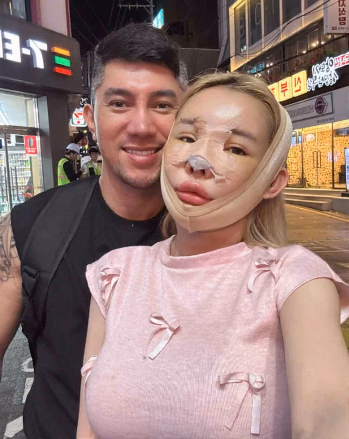 "Mấy đợt trước tôi cũng có nói đi thẩm mỹ muốn làm sao để nhìn mặt của tôi nét nào ra nét đấy, trông phải đứng tuổi và dữ lên tí xíu. Còn lần này, tôi đi sửa cho nó hiền lại. Chắc là tôi không dám sửa nữa đâu, không dám làm ca đại phẫu nữa đâu vì ca vừa rồi quá đau", Ngân 98 cho hay.