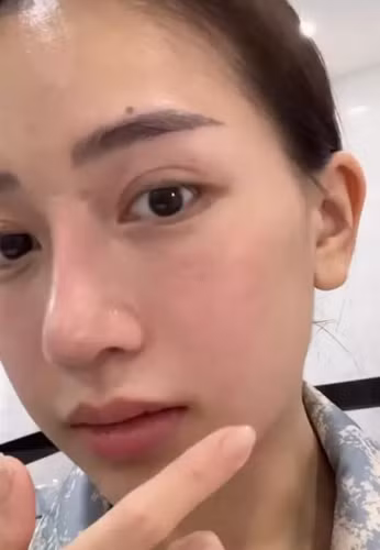 Thời gian qua, hot mom 2 con còn gây chú ý khi tân trang nhan sắc. Cô tiết lộ đã nhấn mí, làm mũi để tự tin hơn.