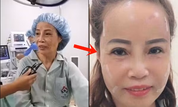 Trước đó, sau khi thực hiện phẫu thuật, cô dâu 62 tuổi Cao Bằng không ngần ngại chia sẻ hình ảnh hiện tại của bản thân cũng như livestream nói chuyện cùng mọi người với gương mặt sưng phù, băng bó kín mít xung quanh.
