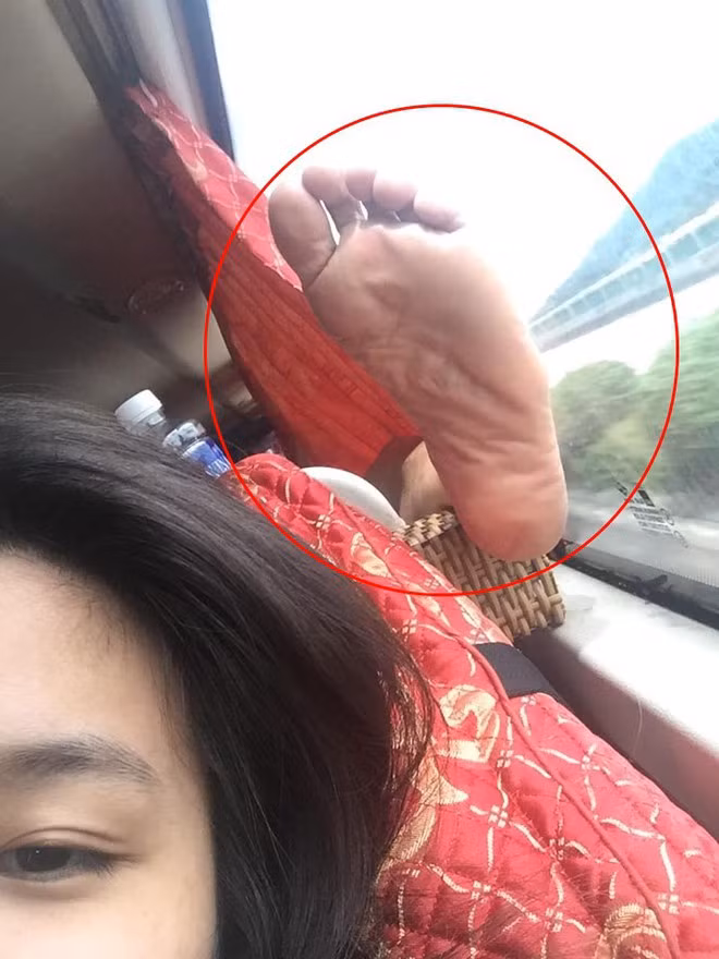 Tình huống bàn chân hư không phải lần đầu xuất hiện nhưng nó phản ánh thực trạng "khó đỡ" của một bộ phận người dân khi tham gia vào phương tiện công cộng.