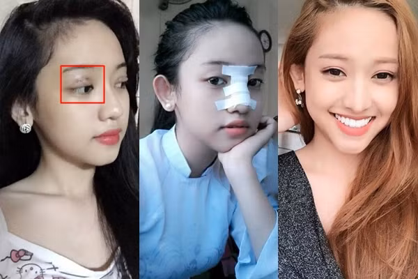 Thúy Vi thừa nhận đi lên nhờ tai tiếng, tiết lộ đang chỉnh sửa nhan sắc - Hình 3 Thuy Vi thua nhan di len nho tai tieng, tiet lo dang chinh sua nhan sac-Hinh-3