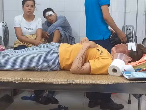 “Lúc đó rất bất ngờ tôi không kịp phản ứng, không kịp la hét gì. Mặt và mắt tôi bỏng rát nên hoảng loạn chạy về phía khu vực xô, chậu đựng nước với hy vọng rửa tránh bị bỏng. Ngay sau đó tôi được đưa đi cấp cứu rồi bất tỉnh cho tới khi tỉnh dậy thấy mình đang nằm trong bệnh viện. Các bác sỹ nói không biết mắt trái có giữ được không” - chị Bùi Thị Nhâm kể lại.