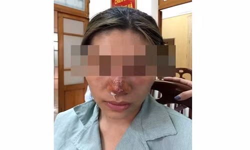 Rước họa vì ham làm đẹp giá rẻ dịp Tết Ruoc hoa vi ham lam dep gia re dip Tet