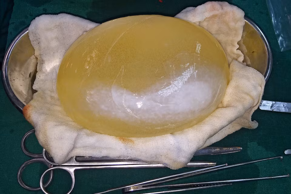 Tiến sĩ Solanki cũng cho hay, gia đình cô bé rất sốc khi biết con gái họ mang trong đầu u nang khổng lồ như vậy. Họ cũng thừa nhận môi trường ô nhiễm tại nơi họ đang sinh sống có thể là nguyên nhân khiến cô bé nhiễm sán.