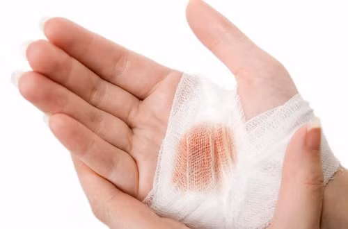 Cách dùng: Bạn lấy 12 - 20g rau ngổ rửa sạch, đem sắc với nước, uống trong ngày. Nếu muốn cầm máu vết thương, bạn chỉ cần lấy cây rau ngổ tươi rửa sạch, giã nát, đắp vào vết thương và cố định lại bằng gạc vô trùng.