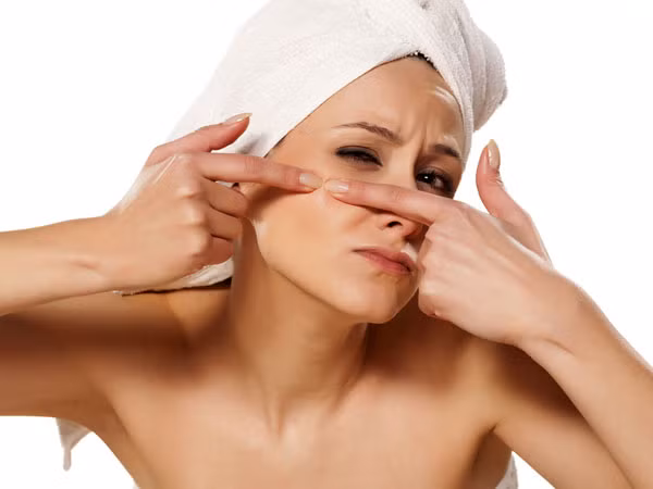 Tránh chạm tay vào mặt, đặc biệt là khu vực bị mụn.