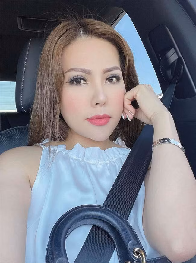 Tuy nhiên dễ dàng nhận ra khuôn mặt của cô đã can thiệp thẩm mỹ.