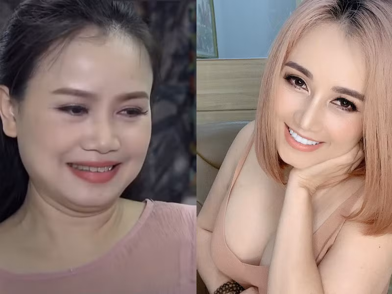 Sau khi ly hôn chồng thứ 4, Hoàng Yến đại tu lại nhan sắc từ sửa mũi tới nâng ngực, làm răng.