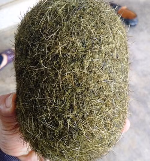 Trư sa, còn được gọi là cát lợn, là một loại sỏi mật lành tính được tích tụ theo thời gian trong cơ thể lợn, đặc biệt là lợn nái nuôi lâu năm.