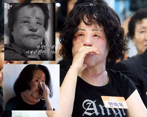 'Thảm họa thẩm mỹ' xứ Hàn qua đời ở tuổi 57: Dùng cả thanh xuân để 'dao kéo' - Hình 4 'Tham hoa tham my' xu Han qua doi o tuoi 57: Dung ca thanh xuan de 'dao keo'-Hinh-4
