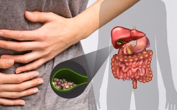 7 kiểu người cực dễ mắc sỏi mật: Lời khuyên từ bác sĩ 7 kieu nguoi cuc de mac soi mat: Loi khuyen tu bac si