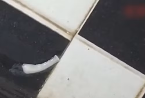 Đi vệ sinh thấy “sợi mì”, hóa ra ký sinh trùng dài 4,9m Di ve sinh thay “soi mi”, hoa ra ky sinh trung dai 4,9m