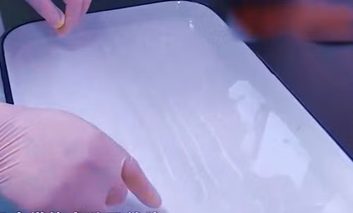 Đi vệ sinh thấy “sợi mì”, hóa ra ký sinh trùng dài 4,9m - Hình 2 Di ve sinh thay “soi mi”, hoa ra ky sinh trung dai 4,9m-Hinh-2