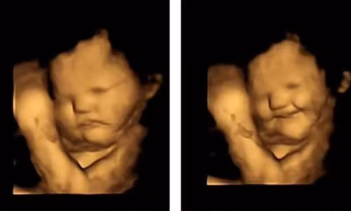 Siêu âm 4D, bác sĩ choáng vì biểu cảm thai nhi cực "gắt" Sieu am 4D, bac si choang vi bieu cam thai nhi cuc
