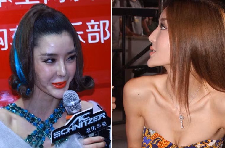 Thời điểm mới nổi lên vài năm trước, hot girl 9x Lý Dĩnh Chi là người đẹp có khuôn mặt ưa nhìn và hài hòa. Nhưng càng ngày cô càng khiến cho “mặt tiền” của mình biến dạng bởi thói nghiện dao kéo và chiếc cằm thì ngày càng vươn ra khiến khuôn mặt của cô khác hẳn trước.