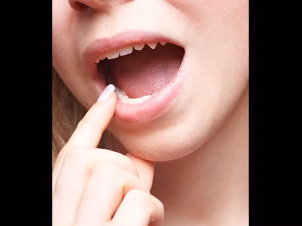 Khoang miệng. Nếu bạn bị đau miệng triền miên và kéo dài trên 2 tuần, hãy đi kiểm tra bác sĩ nha khoa hoặc da liễu ngay lập tức bởi bạn đang có nguy cơ cao mắc ung thư miệng.