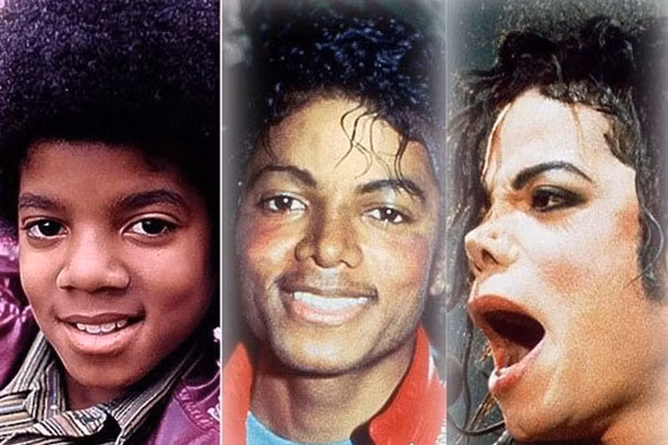 Nhìn ra thế giới, không ít sao ngoại cũng gặp họa vì biến chứng hậu dao kéo mũi. Michael Jackson là một trong số đó. Ảnh: Dân Việt