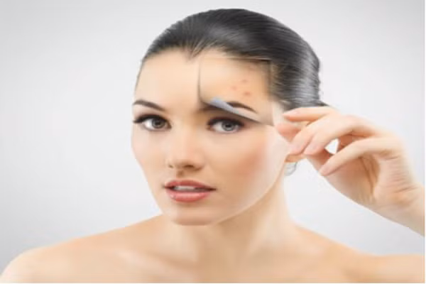 Da nhờn, da dầu. Những cô nàng thuộc da này thường sẽ rất hút bụi bẩn dẫn đến dễ hình thành mụn cám, mụn trứng cá, đầu đen…Các chất tẩy rửa hữu cơ là thích hợp nhất cho việc chống lại làn da dầu vì nó không có bất kỳ tác dụng phụ nào.