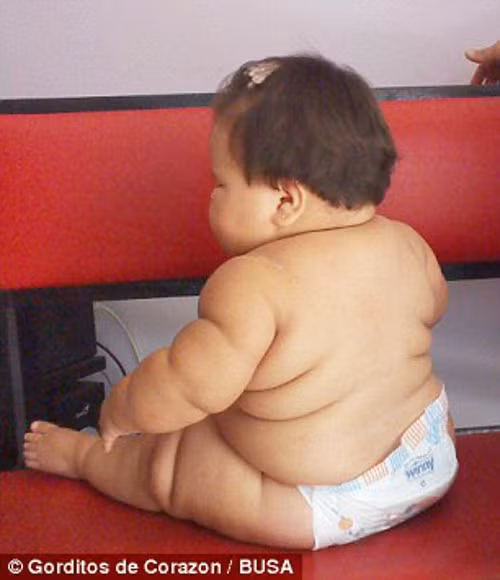 Ông Tam Fry, người bảo trợ Quỹ phát triển Nhi đồng cho biết: “Theo tiêu chuẩn, một em bé 10 tháng tuổi nặng khoảng 8,5kg. Tăng cân là yếu tố cần thiết ở trẻ nhưng tăng quá nhanh dẫn đến béo phì lại là một bi kịch.” Ông Tam Fry, người bảo trợ Quỹ phát triển Nhi đồng cho biết: “Theo tiêu chuẩn, một em bé 10 tháng tuổi nặng khoảng 8,5kg. Tăng cân là yếu tố cần thiết ở trẻ nhưng tăng quá nhanh dẫn đến béo phì lại là một bi kịch.”