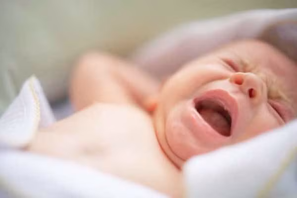  Bệnh vàng da. Nếu vàng da ở trẻ sơ sinh không được chữa trị thì mức độ bilirubin rất cao trong máu có thể gây ra tổn thương não. Tuy nhiên, vàng da ở trẻ sơ sinh thường được cha mẹ trẻ phát hiện và điều trị sớm, do đó các biến chứng này hiện nay đã trở nên rất hiếm. Trị bệnh này cho bé bằng cách đặt trẻ dưới ánh đèn vàng hoặc tắm nắng buổi sáng. Nhớ là phải che chắn mắt bé cẩn thận. 
