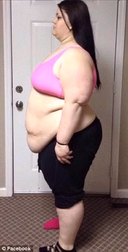 Sau khi nghe câu chuyện của Kaitlyn Smith, bác sĩ Michael Salzhauer ở Miami đã tiến hành làm thủ tục phẫu thuật miễn phí cho cô.