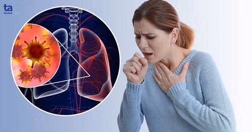 Dấu hiệu ung thư phổi thường gặp nhất là tức và đau ngực. Tình trạng đau diễn ra không đều, dai dẳng ở vai, ngực và lưng.