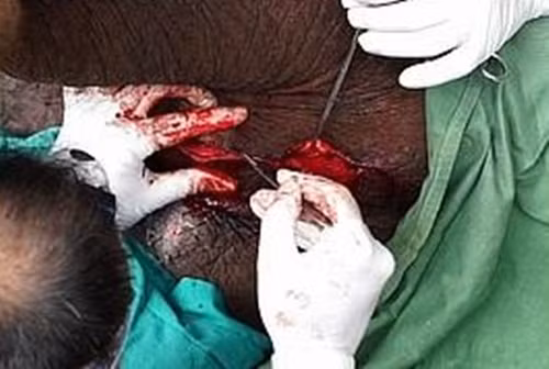 Khi kiểm tra kỹ, người ta mới phát hiện nó là một con voi đực.