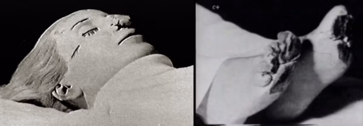 Vào năm 1971, xác ướp của bà Evita được trao trả về cho ông Pedro. Khi ấy, ông đang sống với người vợ thứ ba ở Tây Ban Nha. Thi hài của bà Evita được đặt ở một nhà nguyện trên gác mái trước khi đưa trở về Argentina.