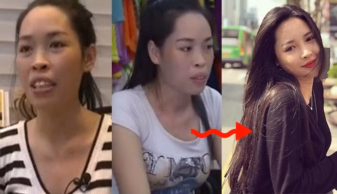 Vũ Thanh Quỳnh được mệnh danh là hot girl thẩm mỹ thành công nhất Việt Nam. Cô gái sinh năm 1992 đến từ Nam Định từng có tuổi thơ sống trong mặc cảm vì bị bạn bè trêu chọc hàm hô, khuôn mặt thiếu cân xứng.