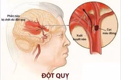 Có những dấu hiệu này, bạn cần đi khám tim mạch ngay Co nhung dau hieu nay, ban can di kham tim mach ngay