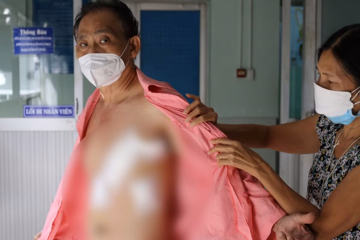 Benh vien Cho Ray trien khai ky thuat moi trong phau thuat tim-Hinh-2