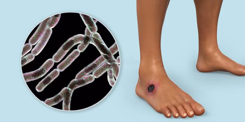 Xác tuần lộc chết sẽ giải phóng bào tử bệnh than, có thể kích hoạt trở lại thành Bacillus anthracis truyền nhiễm trong những trường hợp thích hợp. Mặc dù đây là vi khuẩn chứ không phải vi rút nhưng nó vẫn là lời cảnh báo đối với con người. Ảnh WHO