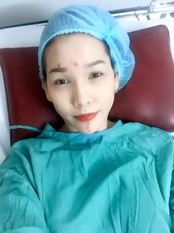 Tuy nhiên, sau khi phẫu thuật sửa mũi, dù bản thân Hoàng My hài lòng nhưng bạn bè của cô, cư dân mạng lại cho rằng ca phẫu thuật đã phản tác dụng. Một số dân mạng cho rằng khuôn mặt Hoàng My hiện tại còn... xấu hơn trước khi làm phẫu thuật sửa mũi.