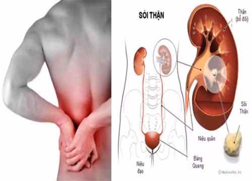 Dưới đây là những loại quả có thể chữa trị bệnh sỏi thận mà bạn có thể dễ dàng kiếm được.