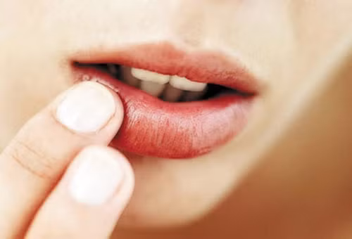Môi đột nhiên có màu đỏ như son có thể do bạn đang bị sốt hoặc mắc các bệnh về tim, cao huyết áp.