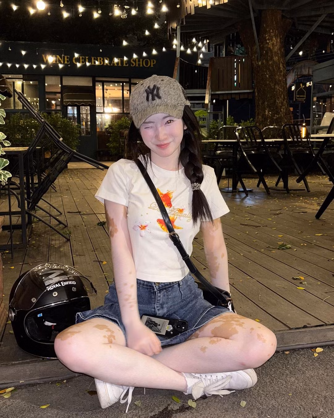 Theo đó, trên làn da trắng sáng của Chralisa ở phần cánh tay, phần đùi là những đốm nâu hiện lên thành các mảng rời rạc, tựa như các vết bớt trông vô cùng nổi bật.